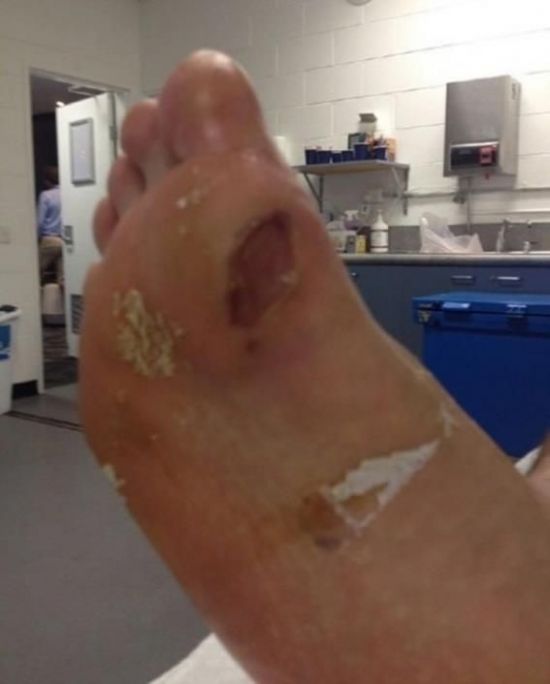 정현, 과거 상처난 발 사진 재조명