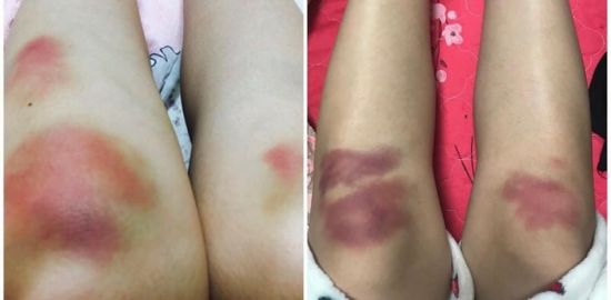 '미투' 이어 '대학가 갑질' 폭로도 충격…홍익대 응원단 ‘도 넘은 악습’ 폭로