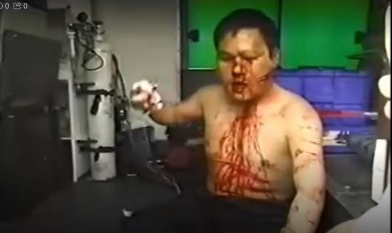 2001년 4월10일 인천 부평구 대우자동차노조 정리해고 반대 집회에서 경찰에 맞아 부상한 노조원이 피를 흘리고 있다. 사진 출처=대우자동차노조 촬영본 캡춰.