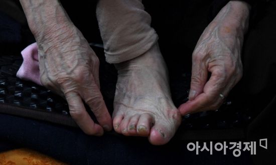65년간 이발 일을 한 이덕훈 할머니의 손과 발./김현민 기자 kimhyun81@