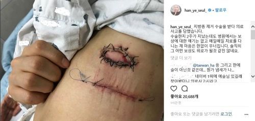 ‘한예슬 의료사고’ 차병원 측 “보상할 것”… 네티즌 “일반인이면 달랐을 것”