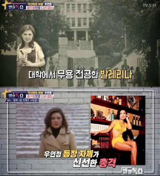 ‘별별톡쇼’ 배우 우연정의 기구한 인생사…골수암·다리절단·남편 외도까지