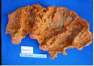 韓연구진, 세계 최초로 바닷속 해면동물서 간암 치료증진 물질 확인