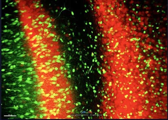 우정바이오 3차원이미징 면역염색키트 신제품 출시