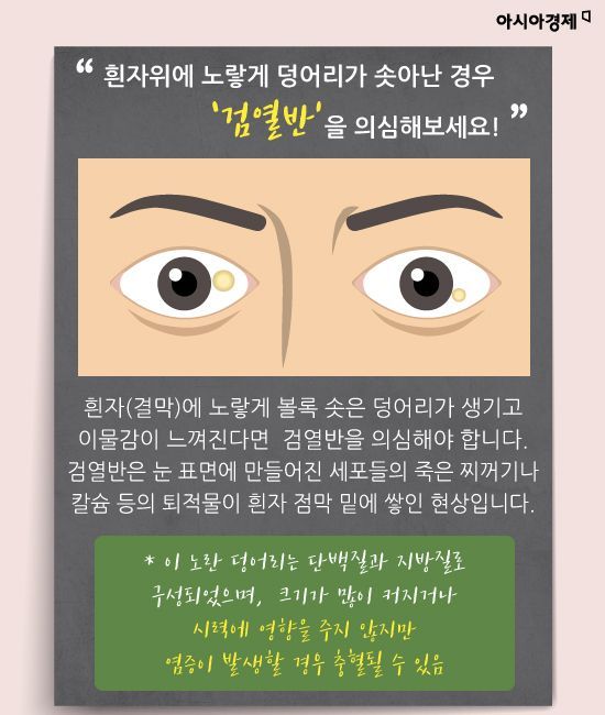 [카드뉴스]눈이 말해주는 '질병 시그널' 미리 알고 건강 챙기세요.