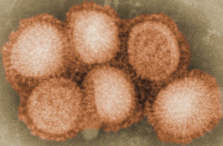H1N1 바이러스 확대 모습. 현재 가장 많이 유행하는 A형독감 바이러스이며, 동물에게는 특별히 전염돼 질환을 일으킨 사례는 없는 것으로 알려졌다.(사진=위키피디아)