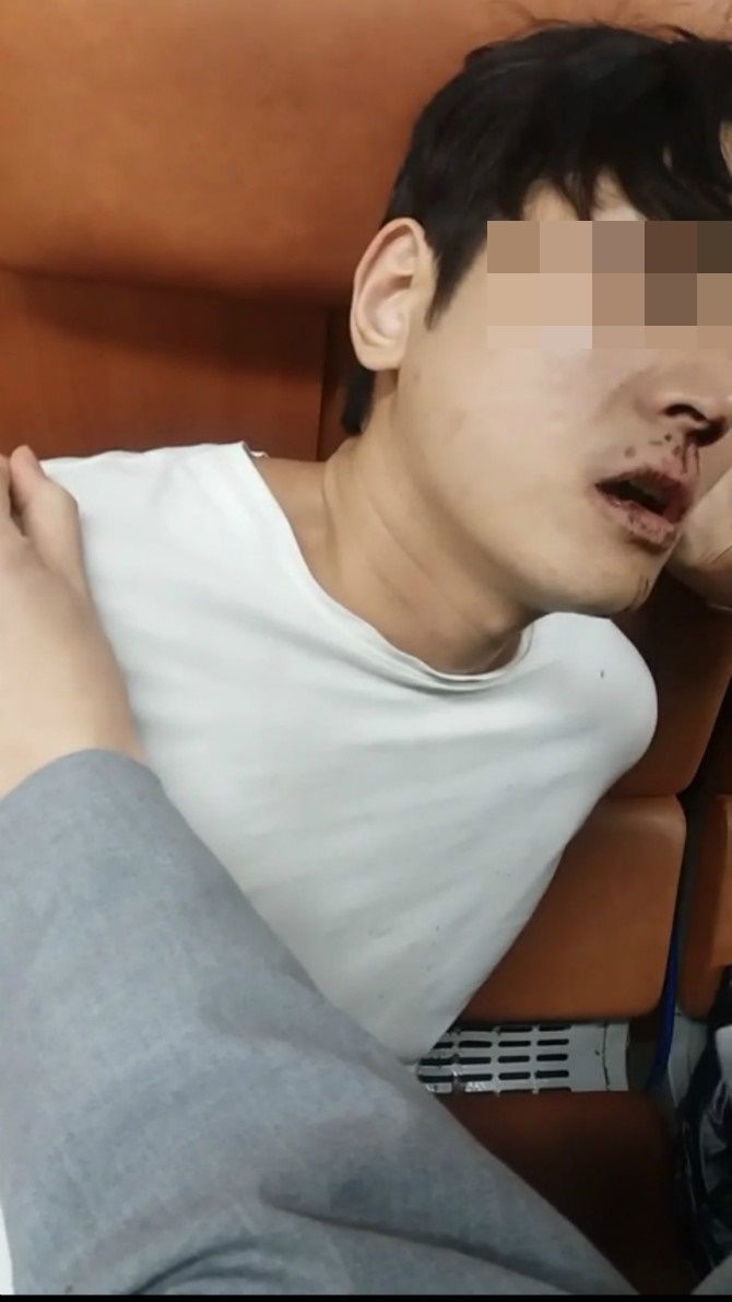 '버닝썬 폭행' 피해자 취재진 피해 경찰 출석…피의자 신분