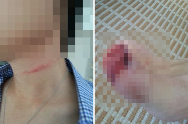 지난 19일 서울 수서경찰서에 조현아 전 대한항공 부사장을 고소한 남편 박모씨가 경찰에 제출한 사진/사진=박 씨 변호인