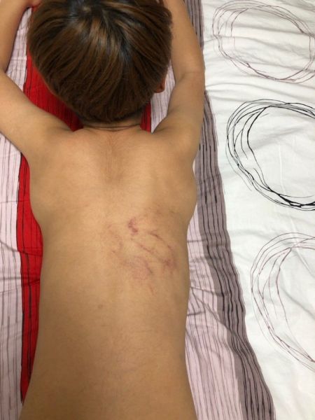 전남 화순에서 초등3학년 담임교사의 상습 폭행
