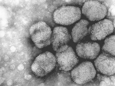 천연두 바이러스의 전자현미경 사진. 출처=픽스니오