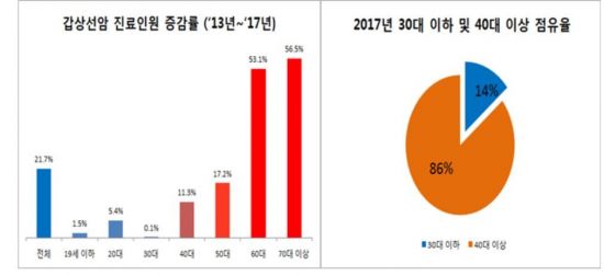 갑상선암 환자 10명 중 8명 40대 이상…여성 환자, 남성의 5배 