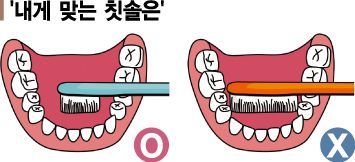 [건강을 읽다] 버리세요, 칫솔모 1/3 휘어진 칫솔 