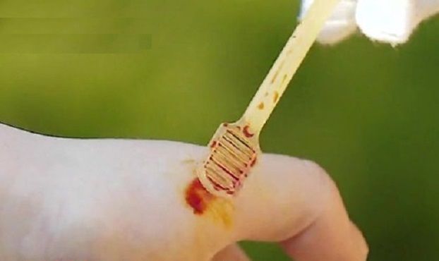 北·日 방사능 우려에 테마주까지 생긴 '요오드'...진짜 효과 있을까?