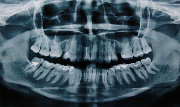 [과학을읽다]나중을 위해 '치아'를 보관한다?