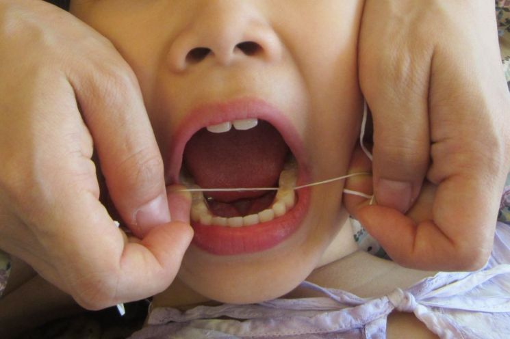 [건강을 읽다] 생후 6개월부터 칫솔질 시작..치실은 매일