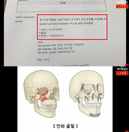 유튜브 채널 '가로세로연구소'(가세연)가 지난 10일 가수 김건모(51)의 폭행 의혹을 추가로 폭로했다/사진=유튜브 채널 '가로세로연구소' 화면 캡처