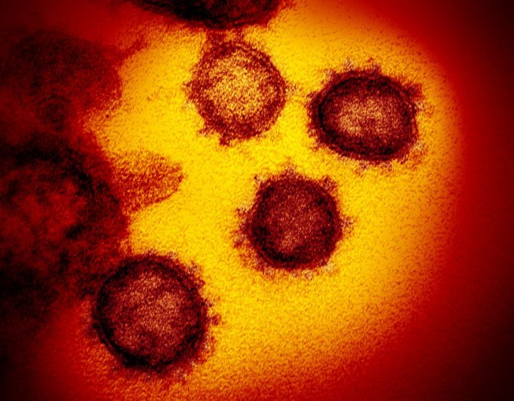 미국 국립보건원이 미국 환자로부터 분리한 2019 신종 코로나 바이러스(2019-nCoV)<이미지:연합뉴스.AP>