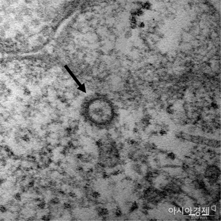 코로나19 바이러스(SARS-CoV-2)의 전자현미경 사진