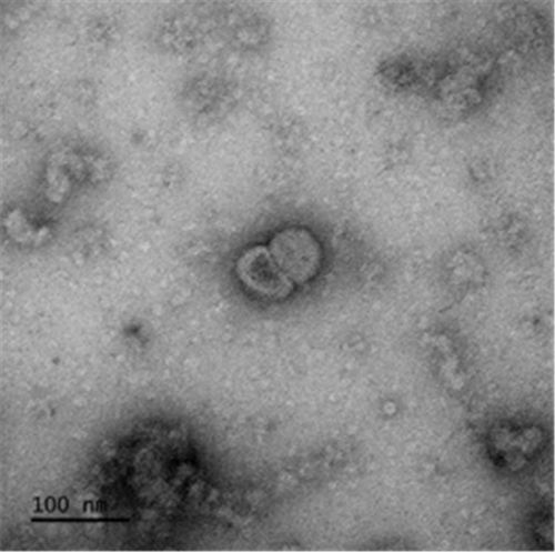 코로나19 바이러스항원(Spike)으로 구성된 바이러스유사체 투과전자현미경 이미지<질병관리본부 제공>