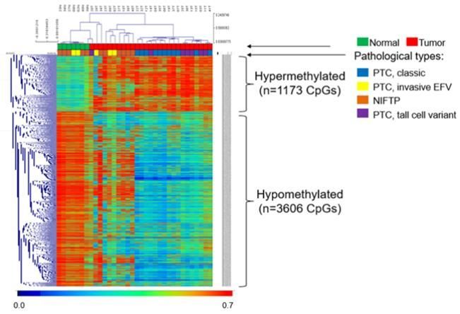 정상조직과 갑상선암 조직에서의 과메틸화(hypermethylated) 및 저메틸화(hypomethylated)가 발생하는 CpG들의 비교 분석