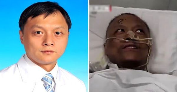 우한중심병원 심장외과 의사 이판(易凡)은 코로나19에 감염돼 2개월 넘게 입원 치료를 받으면서 피부가 검게 변하는 증상을 보였다. 좌측은 코로나19 감염 이전 사진, 우측은 감염 후 병상에 누워있는 모습. / 사진=북경위성방송 캡처