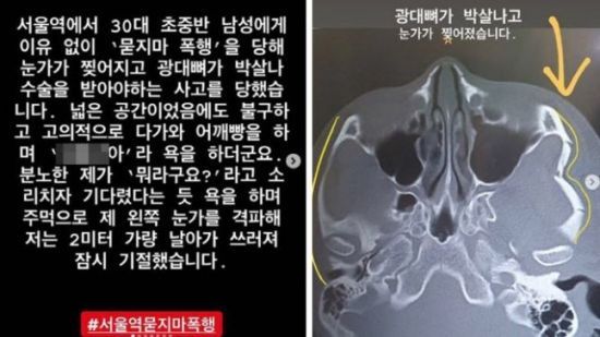 이른바 '서울역 묻지마 폭행 사건'의 피해자가 자신의 소셜네트워크서비스(SNS) 계정에 올린 게시물. / 사진=온라인 커뮤니티 캡처