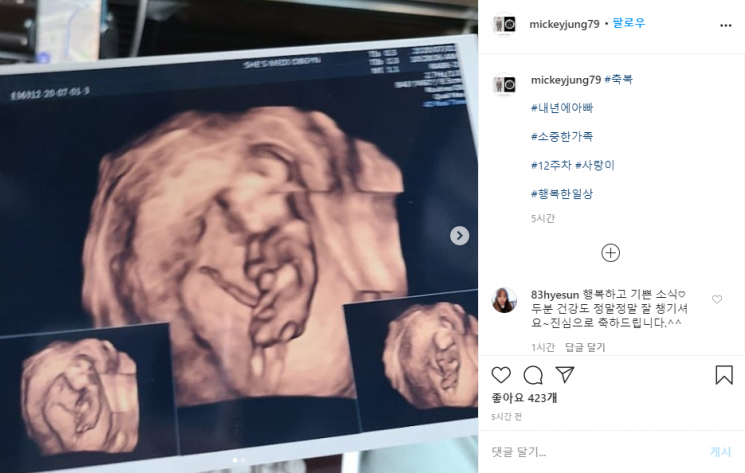 가수 출신 사업가 미키정이 아내의 임신 사실을 전했다. 사진=미키정 인스타그램 캡처.