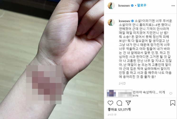 [종합] AOA 지민 "소설" 해명에…권민아 "눈 뜨는 게 고통" 손목 흉터 공개