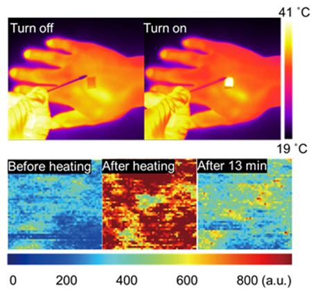 '투명 온열패치'로 여드름 치료한다