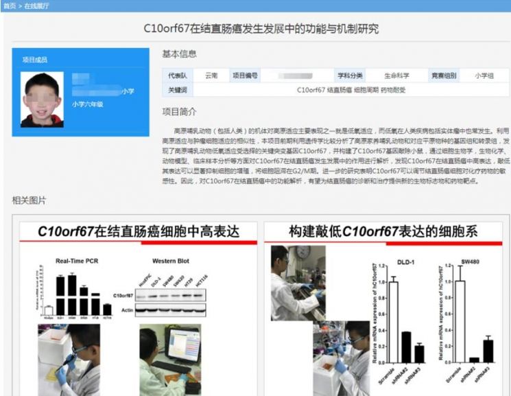 지난해 중국에서 열린 '2019 전국 청소년 과학기술 혁신 대회' 당시 초등학교 6학년생이었던 A 군이 제출한 결직장암 세포 관련 연구 논문. / 사진=중국 '글로벌 타임스' 캡처