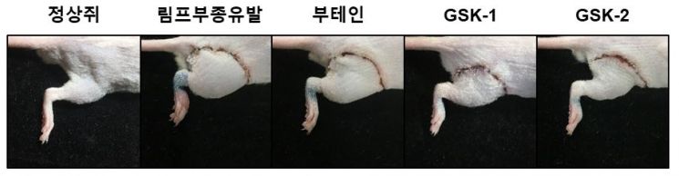 경기바이오센터, 림프부종 치료 신약 후보물질 개발