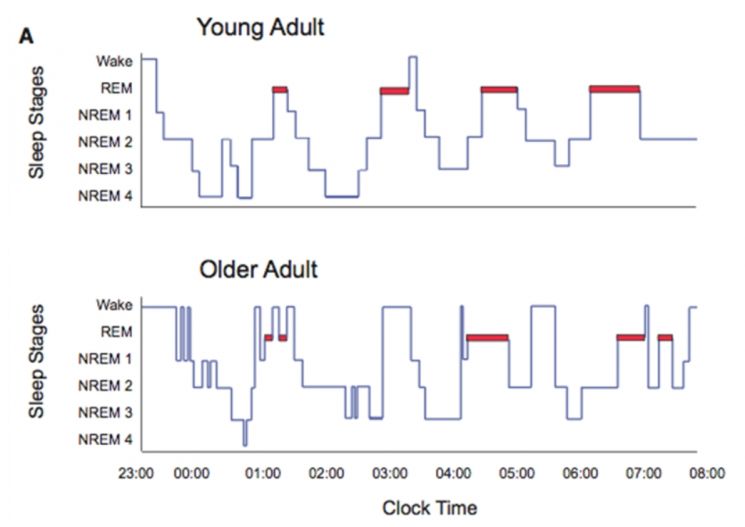 [이용범의 행복심리학] 뇌 노폐물 청소시간 폰·TV 없는 '착한 잠' 자야