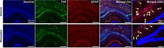 인삼밭 숨은 천연물질.. 알츠하이머 유발물질 '분해'