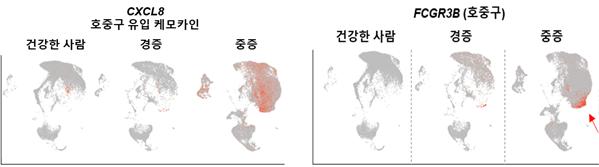 중증 환자의 폐세척액에서 더 높은 CXCL8 케모카인 발현과 호중구 유입이 관찰됐다.