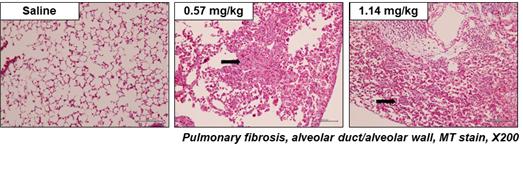 가습기 살균제 성분인 CMIT·MIT의 농도에 따른 폐섬유화의 진행 양상