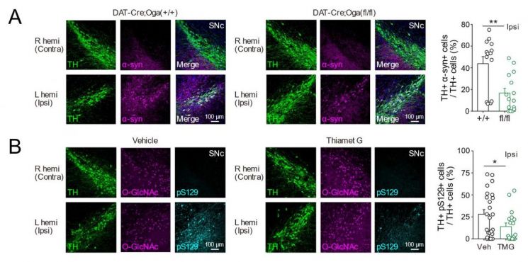 도파민 신경세포에서 오글루넥당화(O-GlcNAcylation)를 증가시켰을 때의 변화