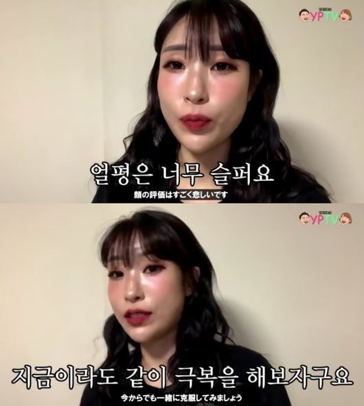 개그우먼 이세영, 쌍꺼풀 수술을 결심한 이유 고백