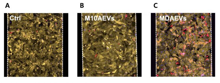 유방암의 나노소포체, 암 전이의 '비료' 