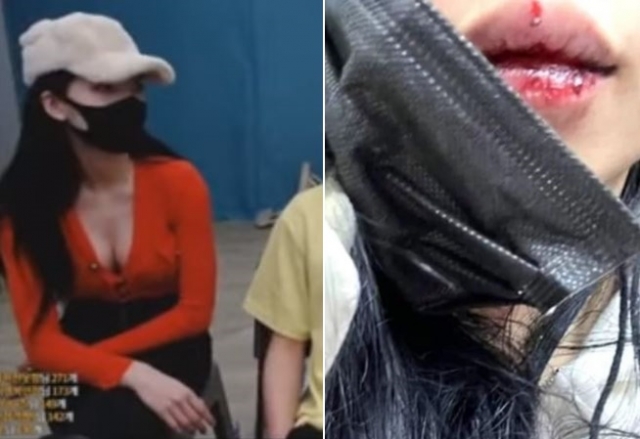 유화(왼쪽)가 공개한 데이트 폭력 피해 사진(오른쪽). 사진=아프리카TV 게시판.