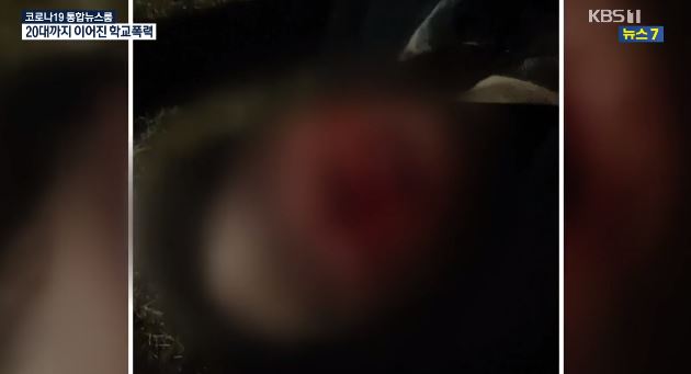 골프채로 피범벅 될 때까지 때려 결국…중학교부터 이어진 악연