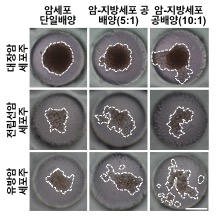 지방세포에 의한 암세포 이동현상