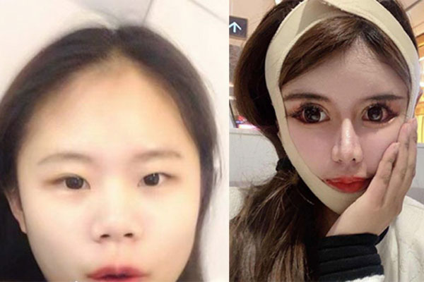 왼쪽은 저우추나의 성형 전, 오른쪽은 성형 후의 모습이다. 사진='쿠리에 자폰' 캡쳐