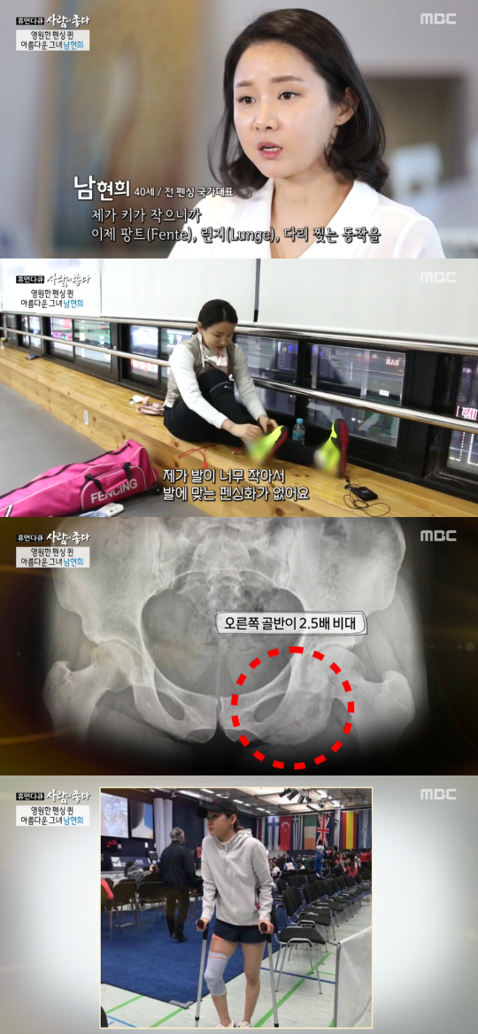 남현희는 과거 한 방송에 나와 작은 키로 인한 고충을 토로한 바 있다. [이미지출처 = MBC '휴먼다큐 사람이 좋다' 방송 캡처]
