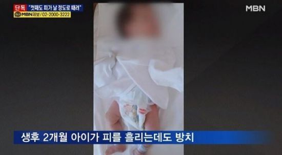 A 씨는 지난해 2월 생후 2개월 된 첫째 딸을 폭행한 혐의로 기소돼 재판을 받던 중이었다. / 사진=MBN 방송 캡처