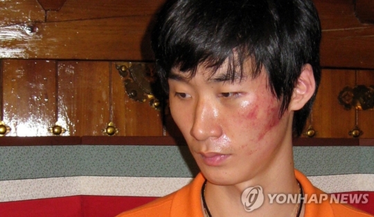 남자배구 한국전력 박철우 선수가 지난 2009년 9월 당시 남자배구 대표팀 이상렬 코치(현 KB손해보험 감독)에게 폭행을 당한 후 기자회견에 나선 모습. /연합뉴스