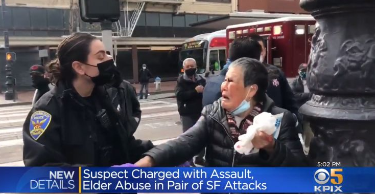 지난 17일 30대 백인 남성에게 무차별 폭행 당한 중국계 여성. [사진=CBS SF BayArea (KPIX 5) 갈무리]