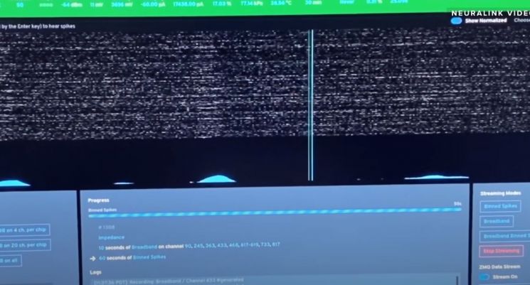 뉴럴링크의 'N1링크'는 원숭이 뇌 속 신경 활동을 모니터링한 뒤, 이를 데이터화하는 작업을 거쳐 게임기 조이스틱에 전송한다. / 사진=유튜브 캡처