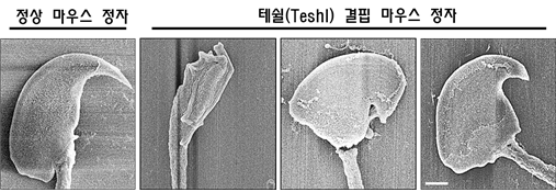 정상 생쥐(마우스) 정자와 테쉴(Teshl) 결핍 생쥐 정자의 비교          
주사전자현미경(scanning electron microscopy)으로 정상 생쥐 정자와 테쉴(Teshl) 결핍 생쥐 정자의 머리 형태를 관찰한 결과이다. 테쉴(Teshl) 결핍 생쥐 정자의 경우, 머리 부분에 다양한 형태적 비정상이 관찰되었다.
[그림설명 및 그림제공 : GIST 홍성현 대학원생 및 조정희 교수]