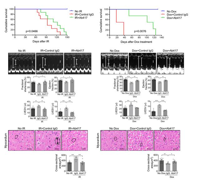 항암제 독소루비신 부작용 '심장 손상' 방지법 찾았다