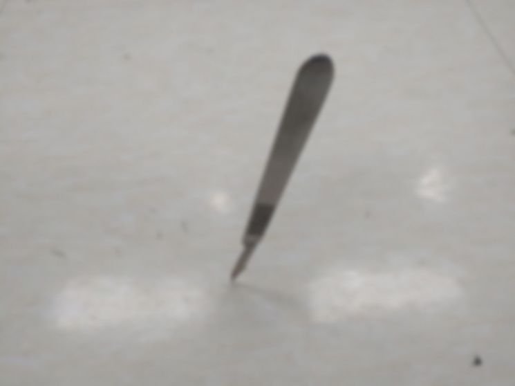 부산대병원 노조는 수술실 집도의가 간호사들에게 폭언하고 수술용 칼을 집어졌다는 피해 간호사들 진술이 나왔다고 23일 밝혔다. 사진은 수술실 바닥에 수술용 칼이 꽂혀있는 모습. 사진=부산대병원 노조·연합뉴스.